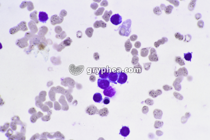 Métastase sanguine x400 - gryphea.org